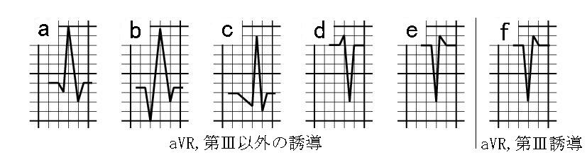./images/00121.jpg