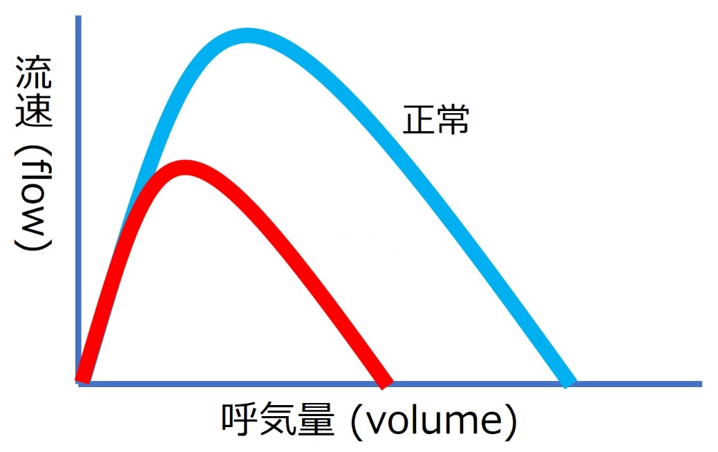 ./images/FlowVolumeQuiz1.jpg