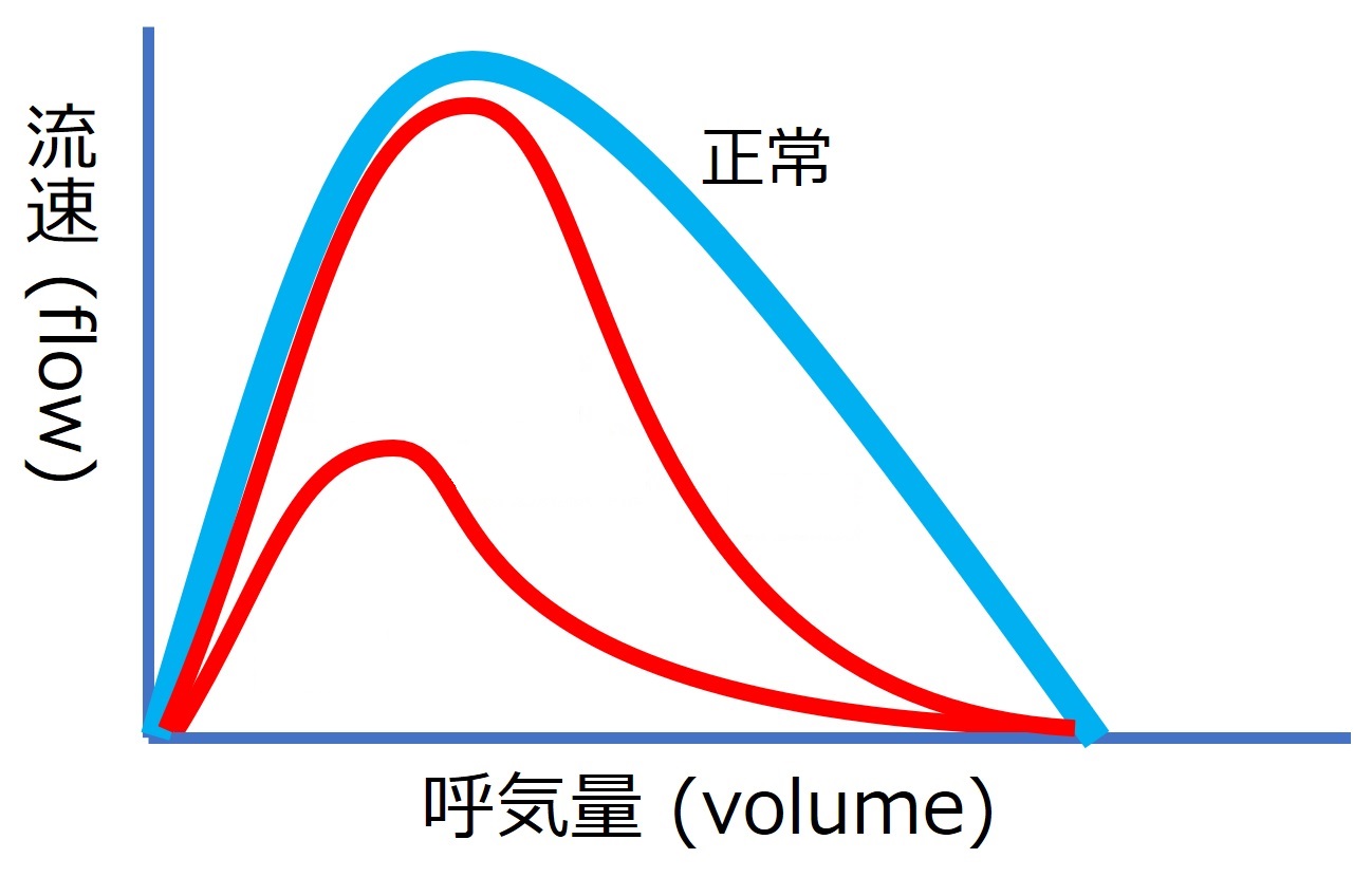 ./images/FlowVolumeQuiz3.jpg