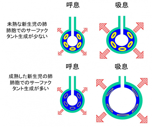 新生児肺.jpg
