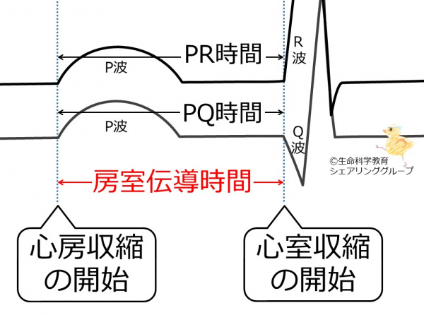 房室伝導時間.jpg