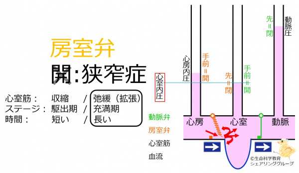 AtrialVentricularValveStenosisHeartSound.jpg