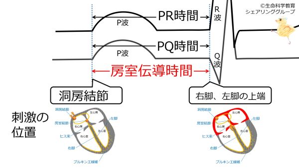 房室伝導時間.jpg