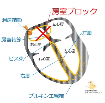延長.jpg