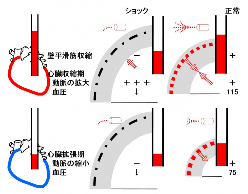 動脈硬化症.jpg