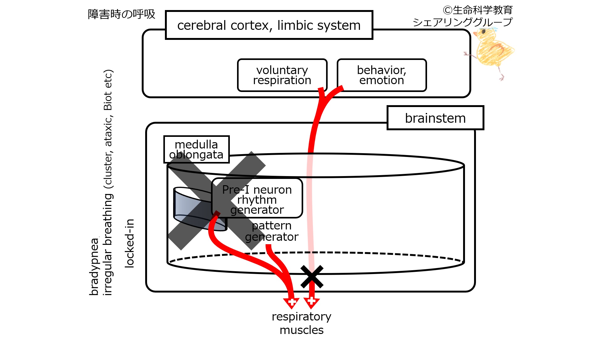 RespiratoryControlMedullaOblongataDamaged.jpg