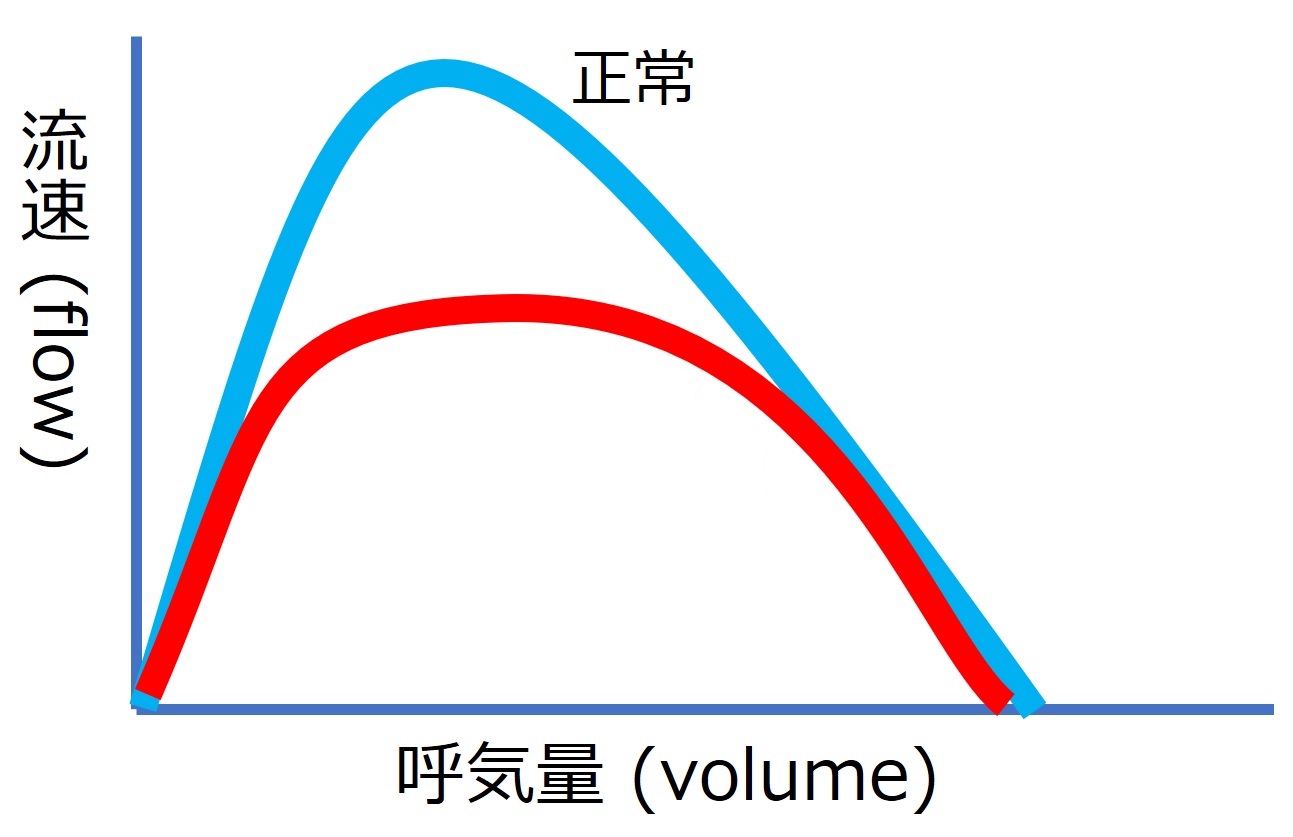 ./images/FlowVolumeQuiz2.jpg