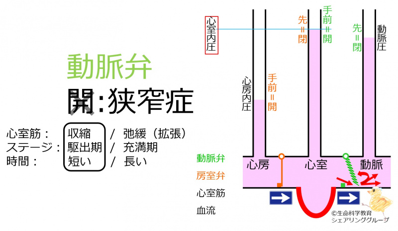 ファイル:ArterialValveStenosisHeartSound.jpg
