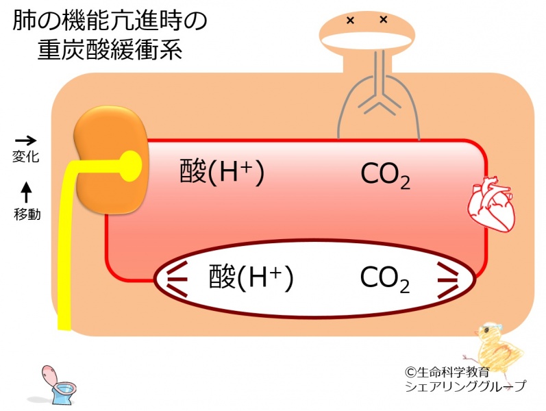 ファイル:BB-hypervent-wb.jpg