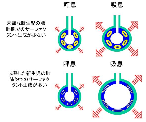 /wiki/images/thumb/1/1b/%E6%96%B0%E7%94%9F%E5%85%90%E8%82%BA.jpg/590px-%E6%96%B0%E7%94%9F%E5%85%90%E8%82%BA.jpg