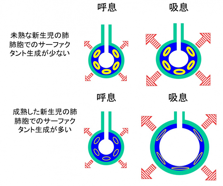 ファイル:新生児肺.jpg