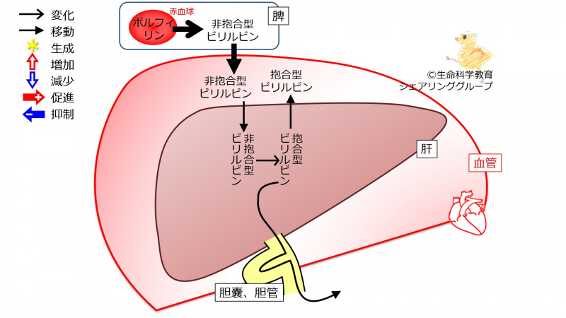 ファイル:BilirubinConjugationFailure-wb.jpg