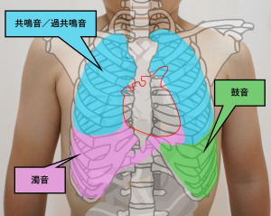 図-胸部呼吸器-打診-打診部位.jpg