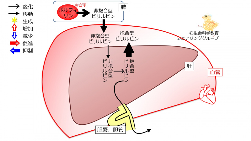 ファイル:BilirubinLiverFailure-wb.jpg