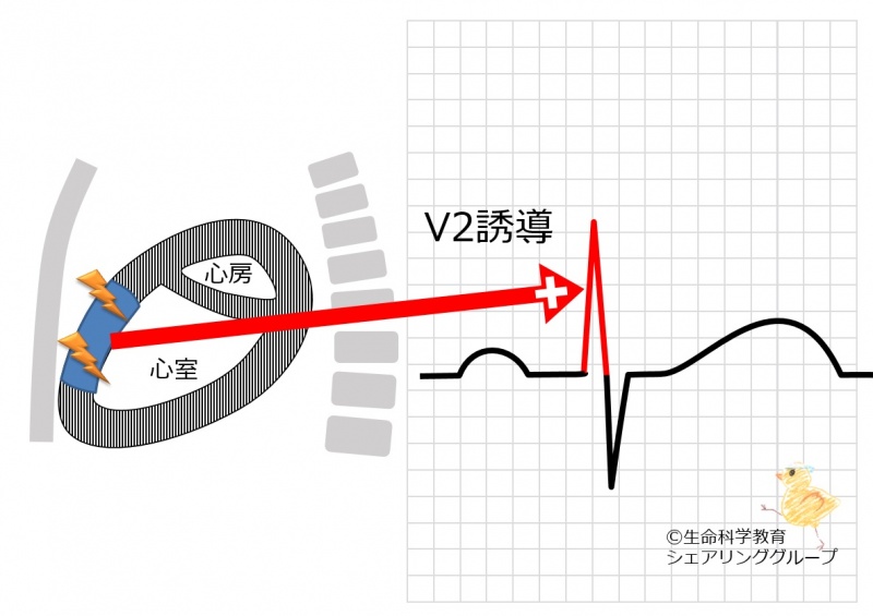 ファイル:V2誘導 R波の意義.jpg