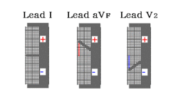 /wiki/images/thumb/2/2a/00051.gif/250px-00051.gif