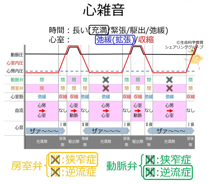 ファイル:DiastolicMurmur.jpg
