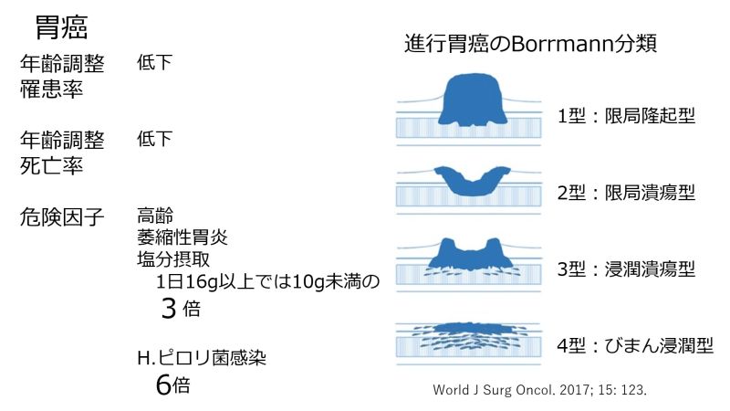 ファイル:GastricCancerIntro-Jpn.jpg