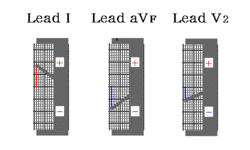 /wiki/images/thumb/5/5f/00045.gif/250px-00045.gif