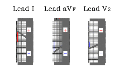 /wiki/images/thumb/5/5f/00045.gif/400px-00045.gif