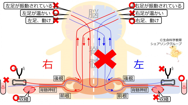 ファイル:SpinalCordLeftHemiSec.jpg