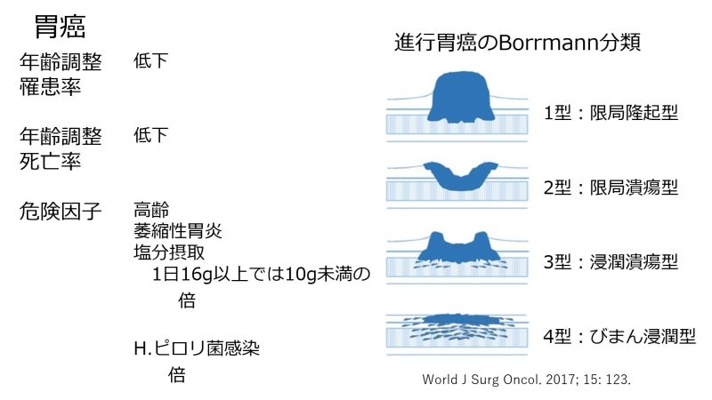 ファイル:GastricCancerIntro-Jpn-wb.jpg