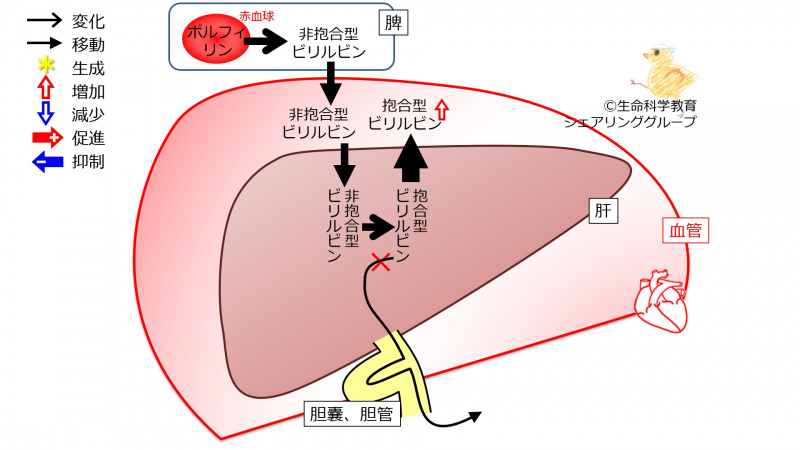 ファイル:BilirubinExcretionFailure.jpg