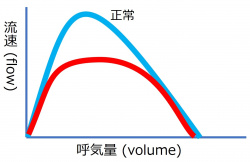 /wiki/images/thumb/6/6e/FlowVolumeQuiz2.jpg/250px-FlowVolumeQuiz2.jpg