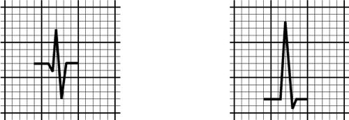 /wiki/images/thumb/7/70/00071.jpg/500px-00071.jpg