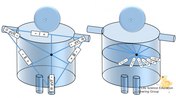 Ecg12LeadsPolarity.jpg