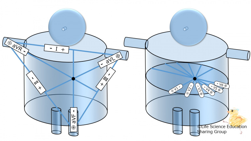 ファイル:Ecg12LeadsPolarity.jpg