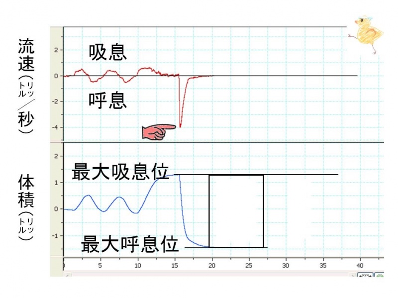 ファイル:03157-wb.jpg