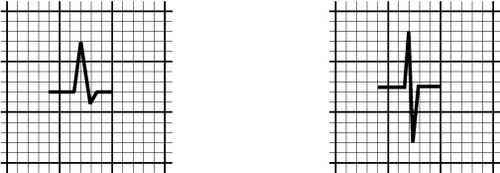 /wiki/images/thumb/7/7e/00072.jpg/500px-00072.jpg