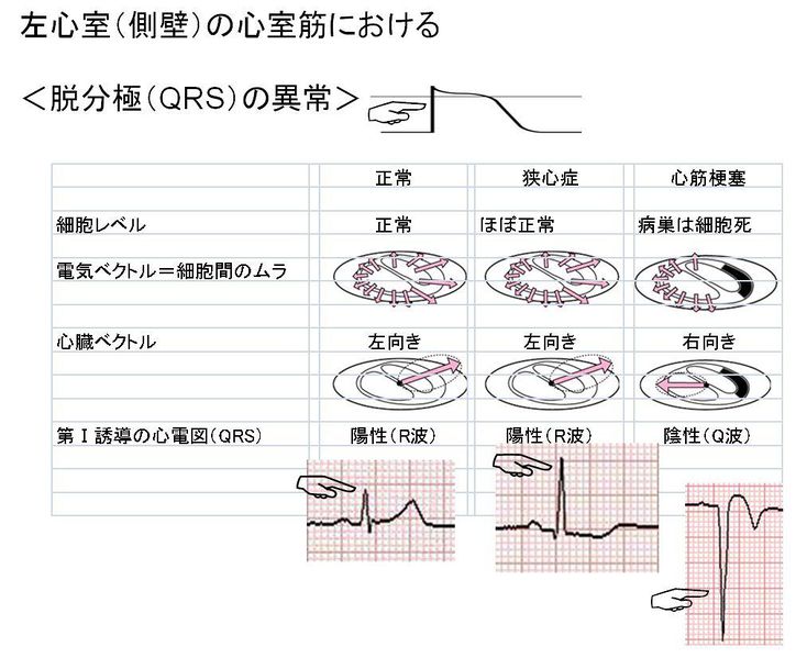 ファイル:02472.jpg