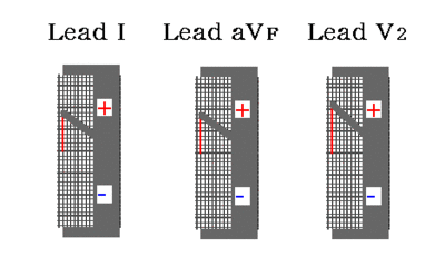 /wiki/images/thumb/8/8a/00049.gif/400px-00049.gif