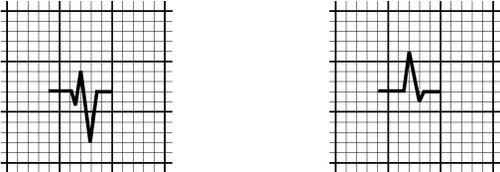 /wiki/images/thumb/8/8f/00074.jpg/500px-00074.jpg