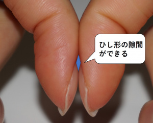 図-皮膚爪-視診2-爪の隙間.jpg