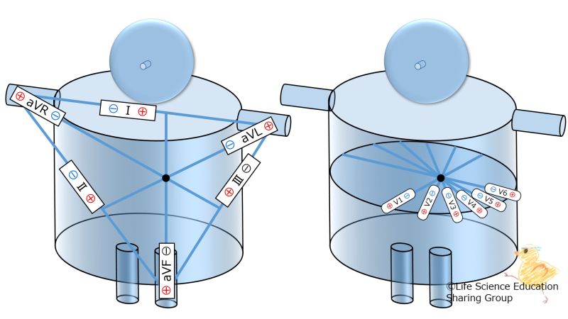 ファイル:Ecg12LeadsPlane.jpg