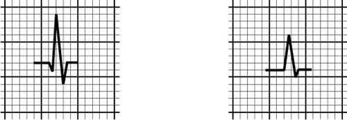 /wiki/images/thumb/a/aa/00073.jpg/500px-00073.jpg