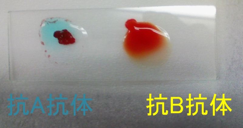 ファイル:TypeAaggregation.jpg