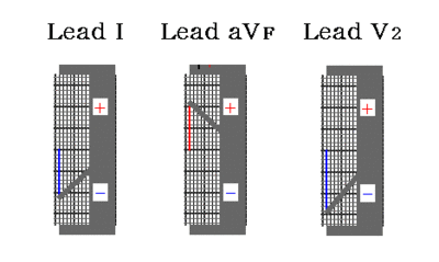 /wiki/images/thumb/c/c9/00047.gif/400px-00047.gif