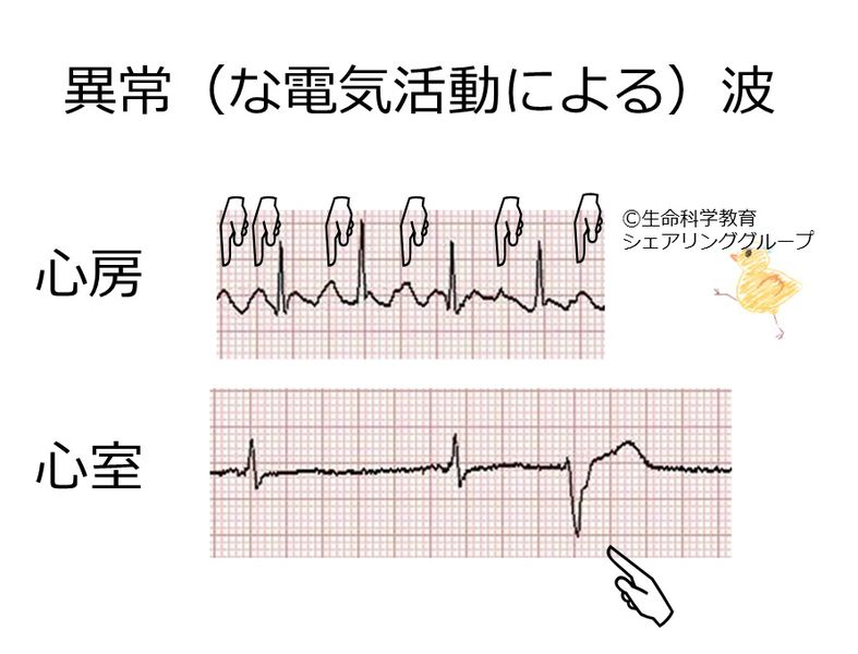 ファイル:異常波.jpg