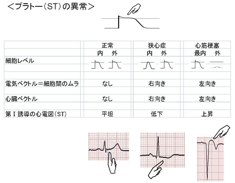 ファイル:02473.jpg