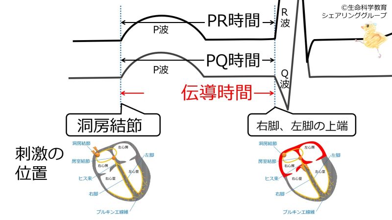 ファイル:房室伝導時間-wb.jpg