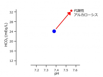 PH-HCO3-metabolic-alkalosis.jpg