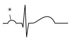 /wiki/images/thumb/e/eb/%E6%B3%A2%E5%BD%A2%E3%81%AE%E5%90%8D%E7%A7%B0_%E3%82%AF%E3%82%A4%E3%82%BA1.jpg/250px-%E6%B3%A2%E5%BD%A2%E3%81%AE%E5%90%8D%E7%A7%B0_%E3%82%AF%E3%82%A4%E3%82%BA1.jpg