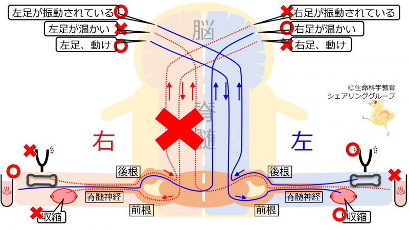 ファイル:SpinalCordRightHemiSec.jpg