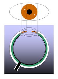 /wiki/images/thumb/f/f4/01522en.jpg/200px-01522en.jpg