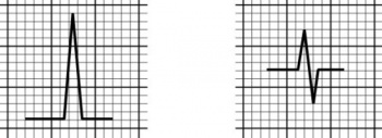 /wiki/images/thumb/f/f9/00086.jpg/350px-00086.jpg