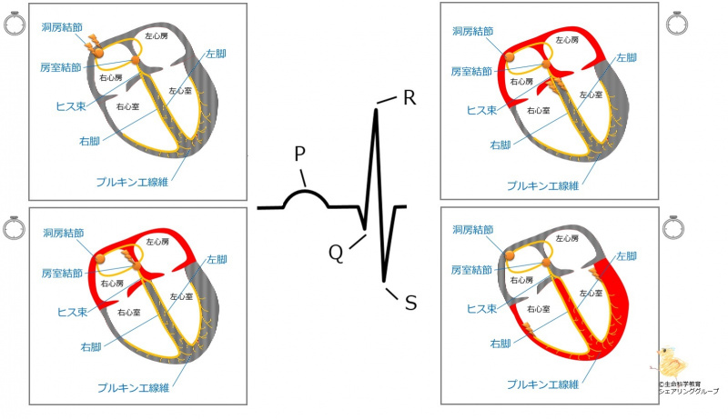 ファイル:P波のはじめQ(R)波のはじめ-wb.jpg